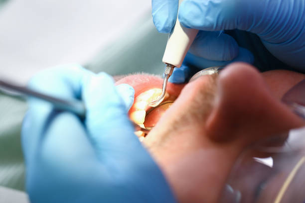 Best Emergency Orthodontic Repairs in Woodville, FL