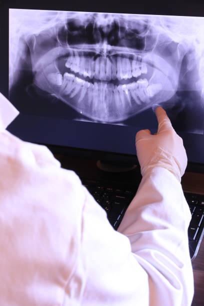 Best Emergency Tooth Extraction in Woodville, FL