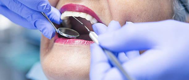 Best Emergency Root Canal Treatment in Woodville, FL