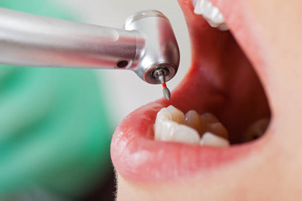 Best Pediatric Emergency Dentist in Woodville, FL
